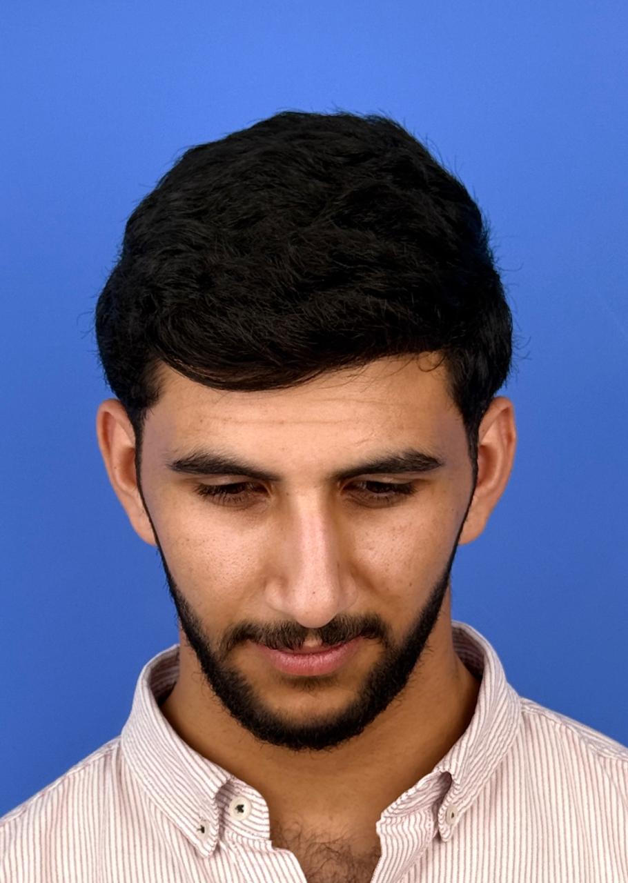 صورة قبل