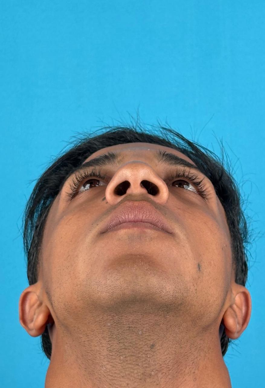 صورة قبل
