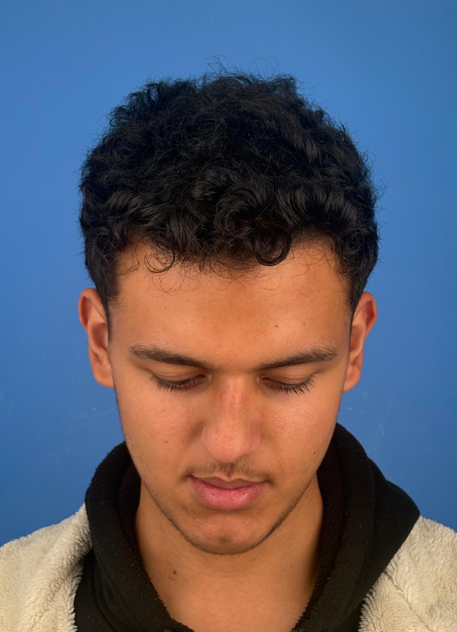 Before image