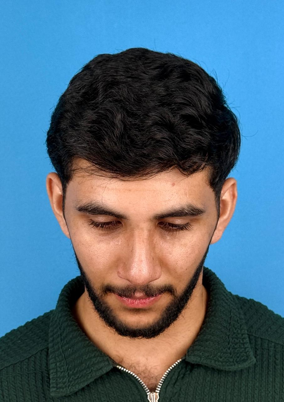 After image